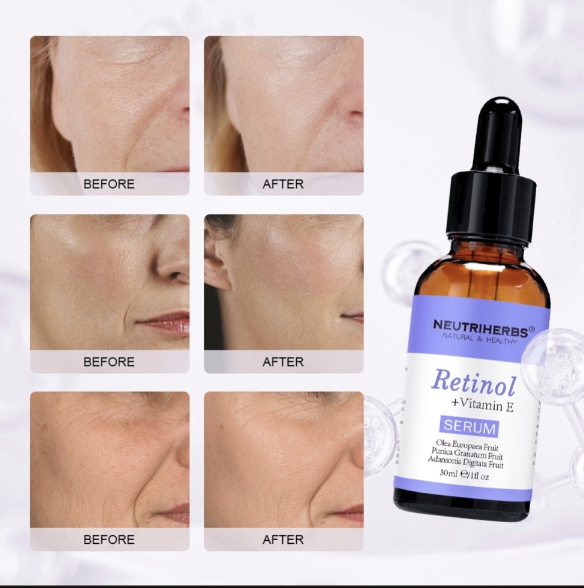 Retinol + Vitamin E Serum thumbnail 7