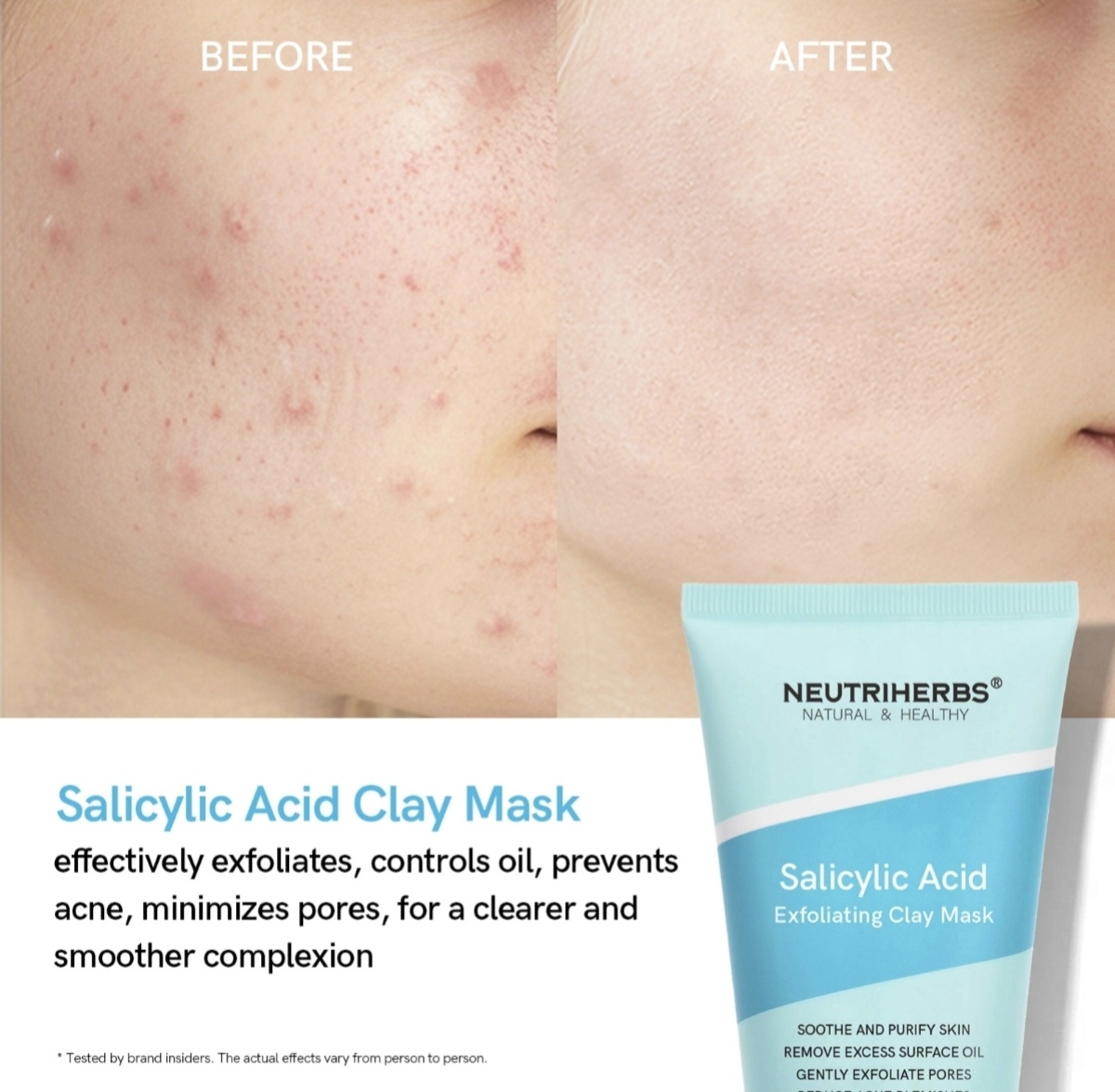 Salicylic Acid Exfoliating Clay Mask thumbnail 9