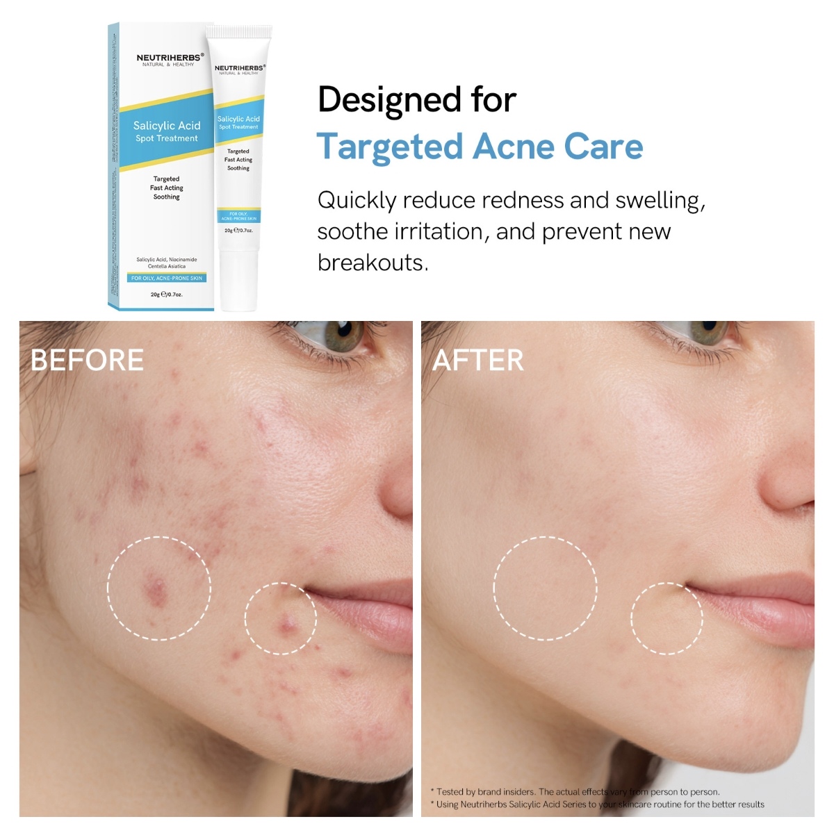 Salicylic Acid Spot Treatment thumbnail 4