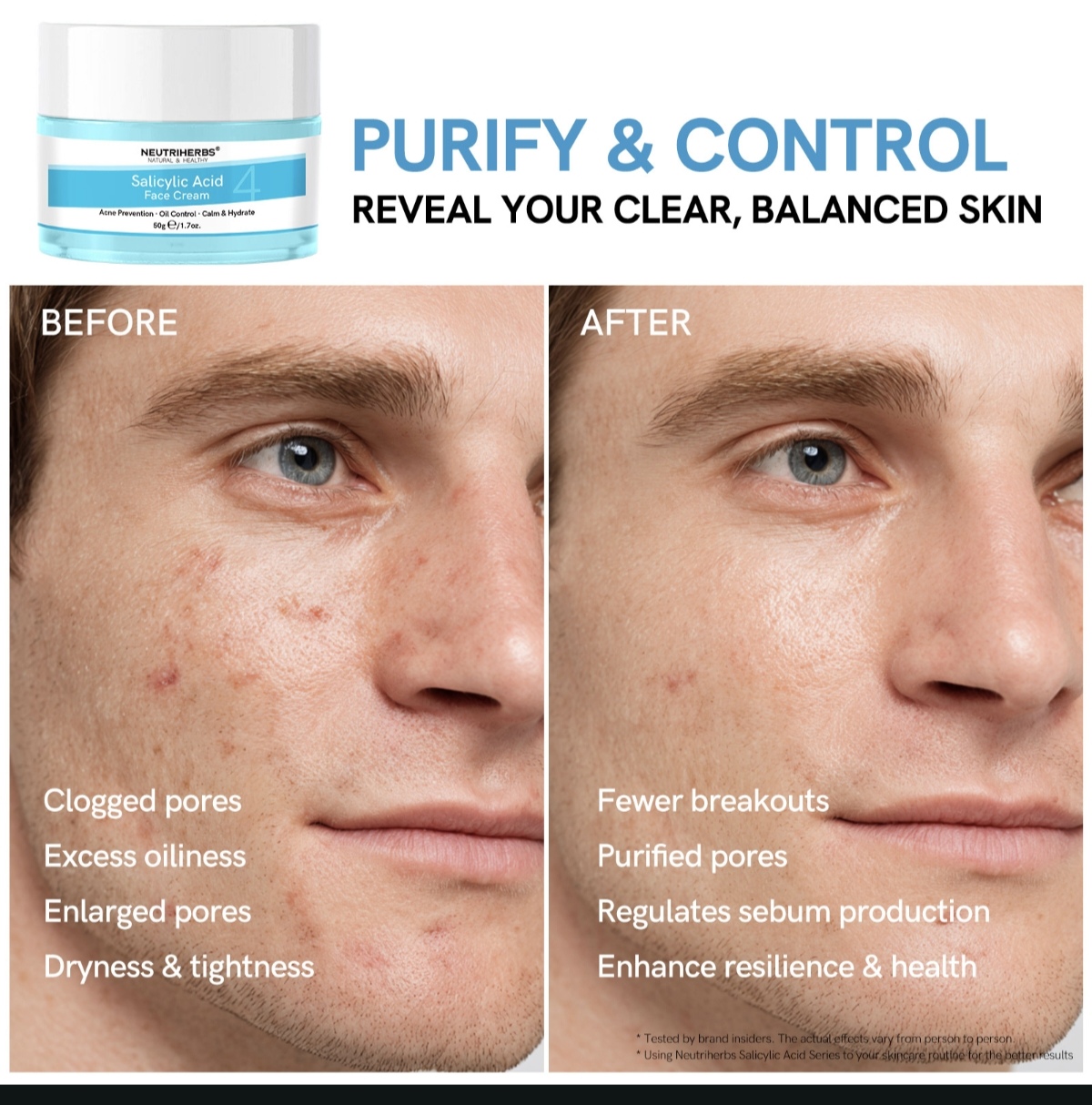 Salicylic Acid Face Cream thumbnail 8