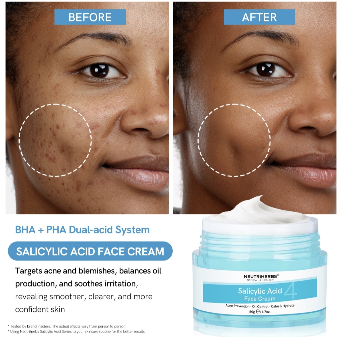 Salicylic Acid Face Cream thumbnail 3